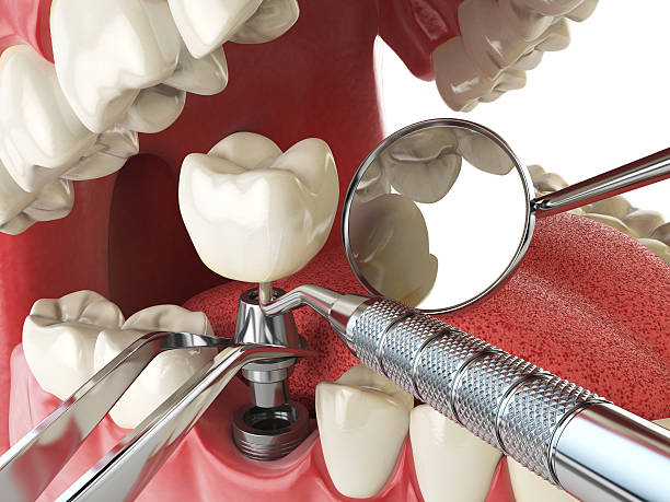 Best Emergency Treatment for Toothache in Selbyville, DE